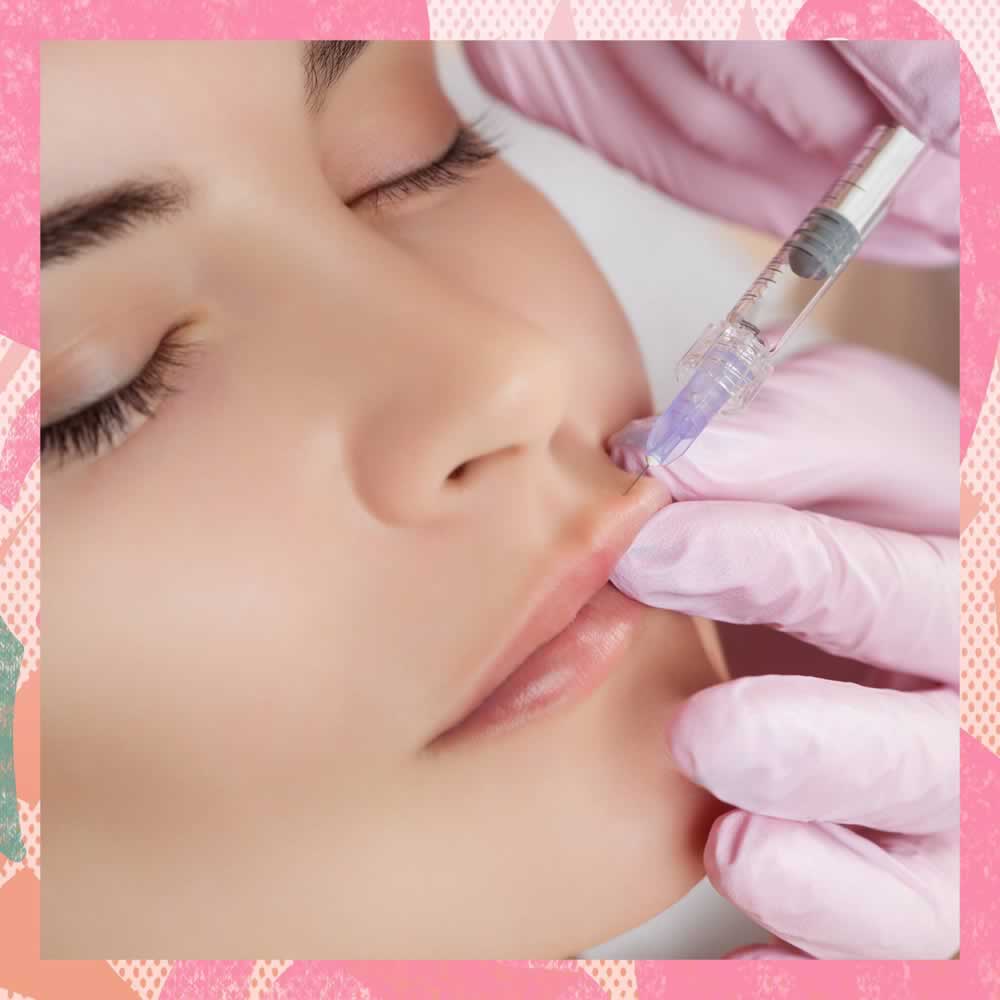 Female patient receiving dermal filler lip plumping treatment injections.